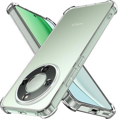 Coque XEPTIO Honor Magic 8 Lite coque bords