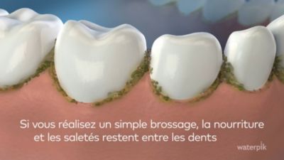 Voir la vidéo pour Hydropulseur WATERPIK WF-150