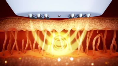 Voir la vidéo pour Appareil anti rides NEWA anti-age visage